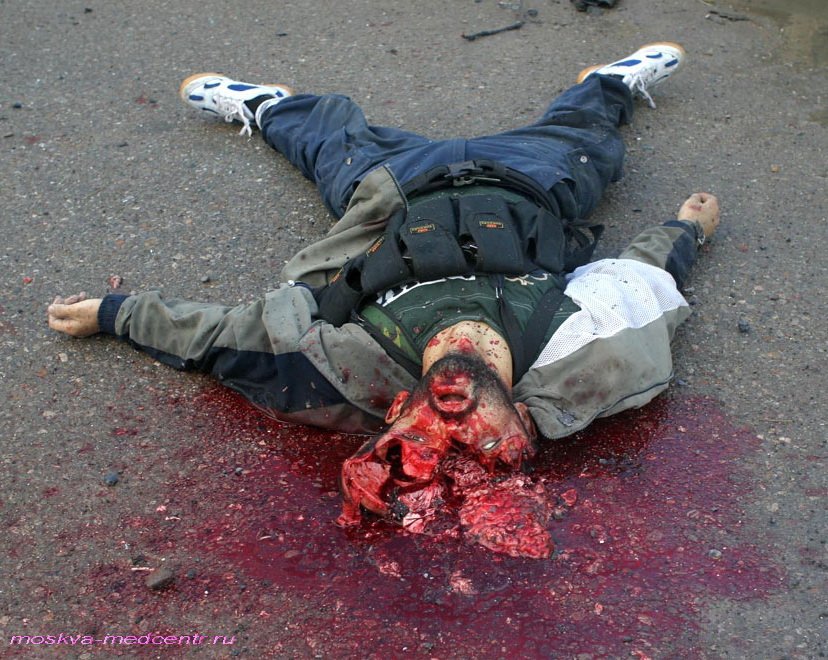 Ужасы медицины - фото убитых боевиков в военно-полевом морге.